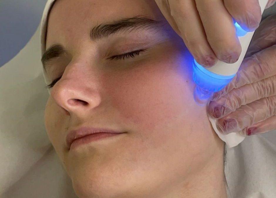 Tractament facial no invasiu HidroAge